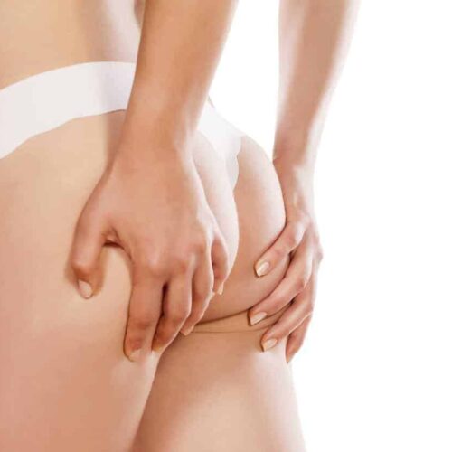 Buttock Augmentation